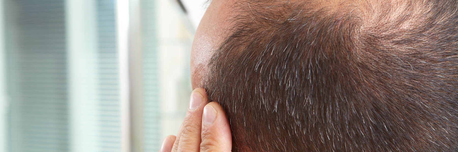 Hair Loss Treatment