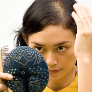 Portland Scarring Alopecia Treatment